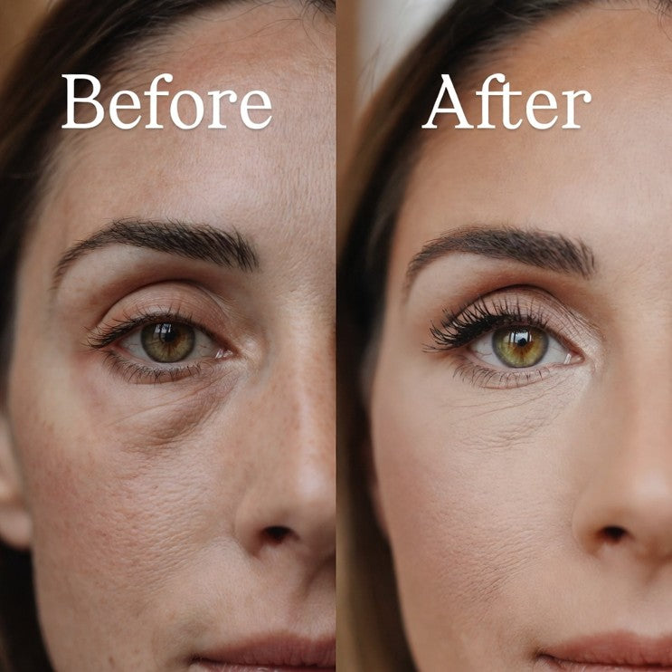 EYE CREAM