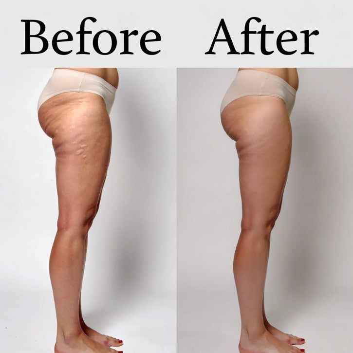 ANTI-CELLULITE CREAM