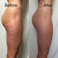 ANTI-CELLULITE CREAM
